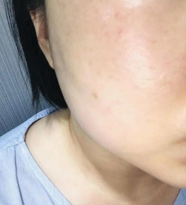 갈락토미 나이아신 에센스 50ml
