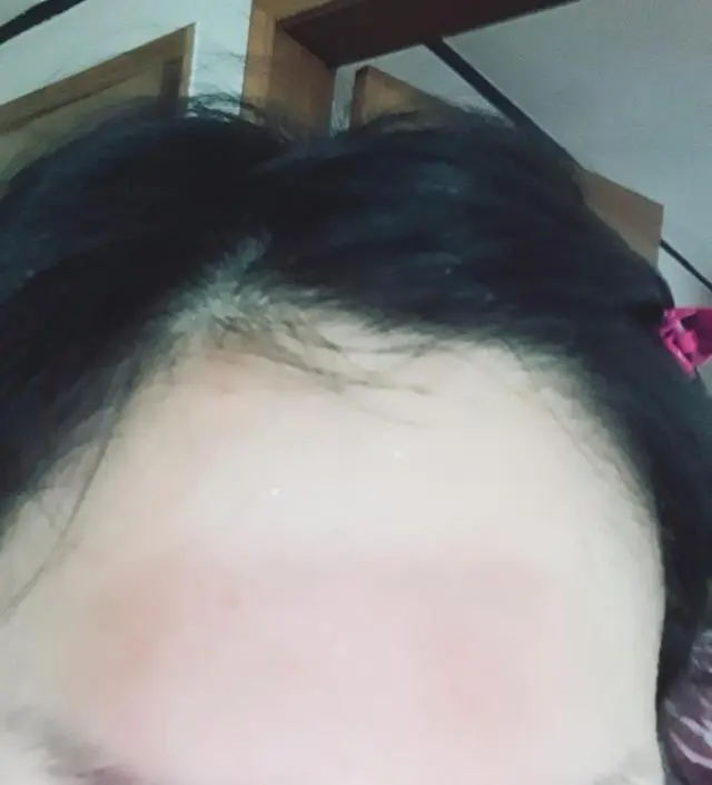 갈락토미 나이아신 에센스 50ml
