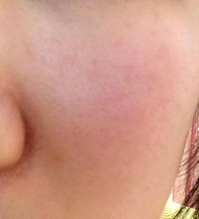 갈락토미 나이아신 에센스 50ml
