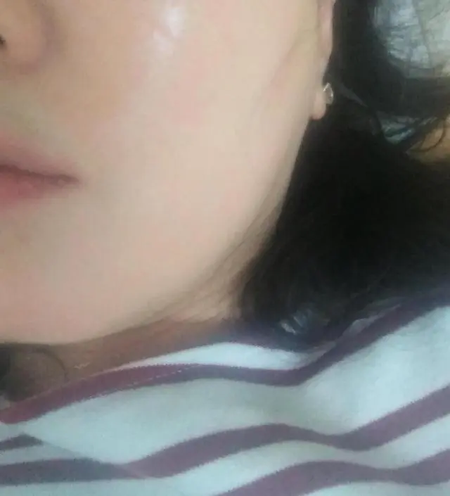 갈락토미 나이아신 에센스 50ml
