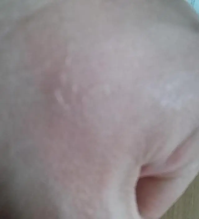 갈락토미 나이아신 에센스 50ml
