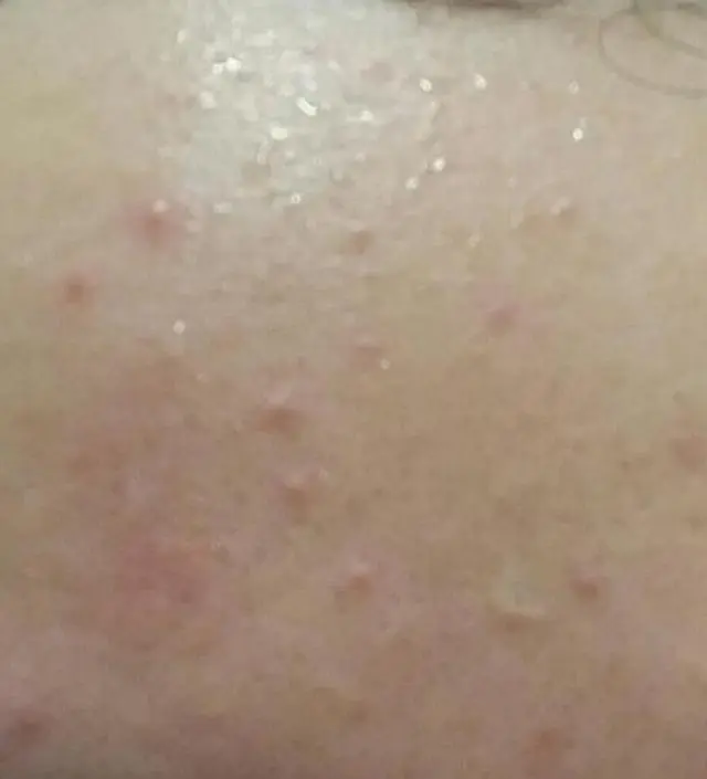 갈락토미 나이아신 에센스 50ml
