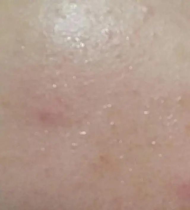 갈락토미 나이아신 에센스 50ml
