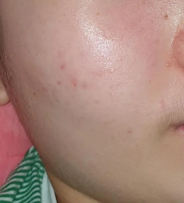 갈락토미 나이아신 에센스 50ml
