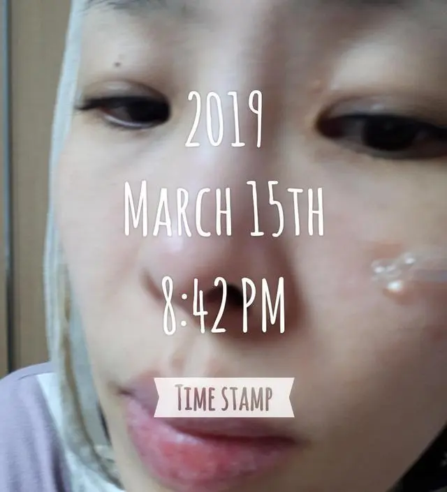 갈락토미 나이아신 에센스 50ml
