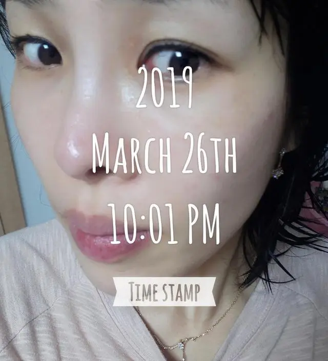 갈락토미 나이아신 에센스 50ml
