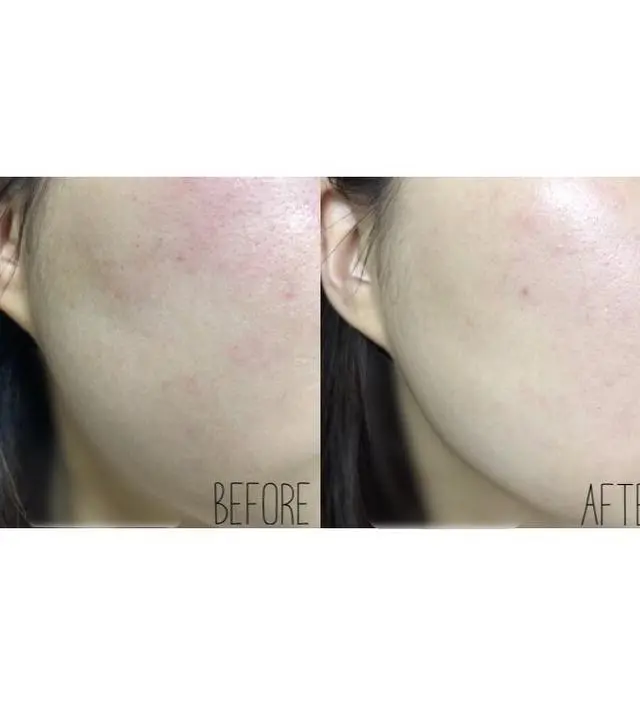 갈락토미 나이아신 에센스 50ml
