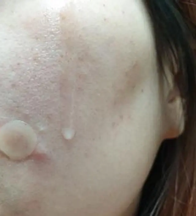 갈락토미 나이아신 에센스 50ml
