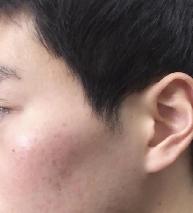 갈락토미 나이아신 에센스 50ml
