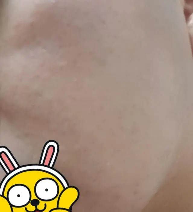 갈락토미 나이아신 에센스 50ml
