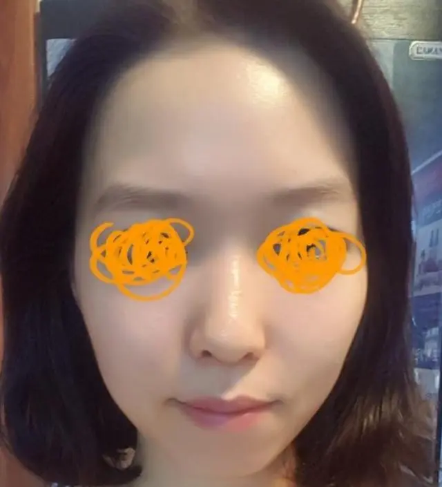 갈락토미 나이아신 에센스 50ml
