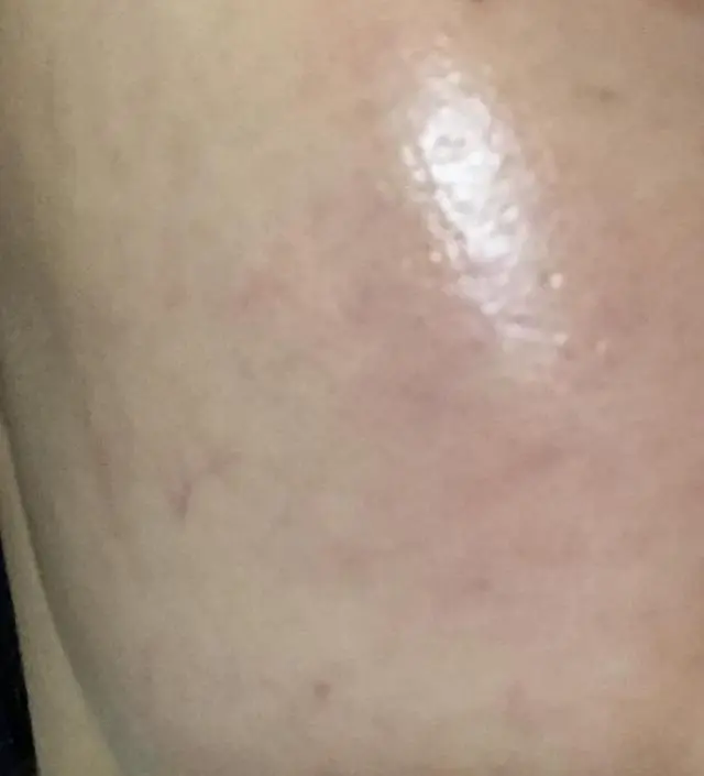 갈락토미 나이아신 에센스 50ml
