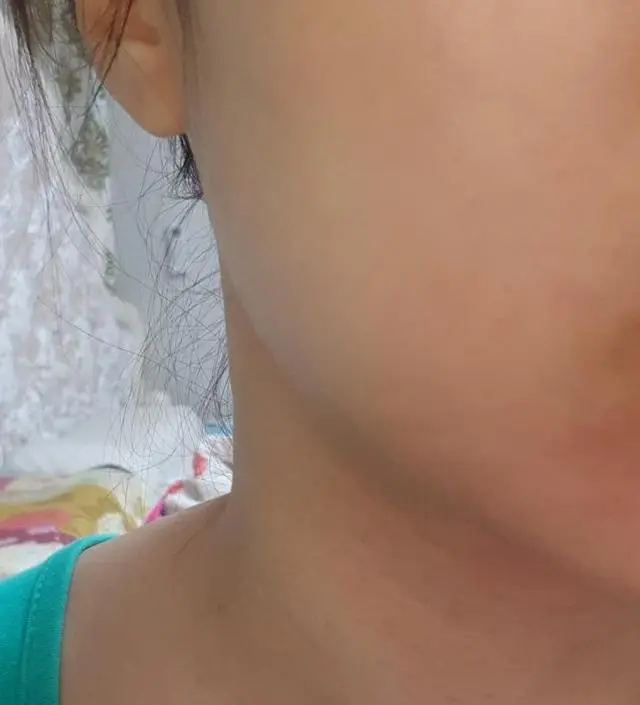 갈락토미 나이아신 에센스 50ml
