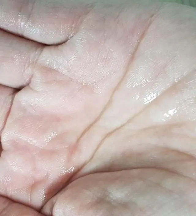 갈락토미 나이아신 에센스 50ml
