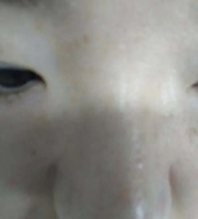 갈락토미 나이아신 에센스 50ml
