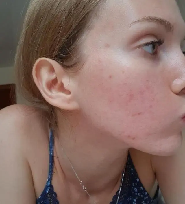 갈락토미 나이아신 에센스 50ml
