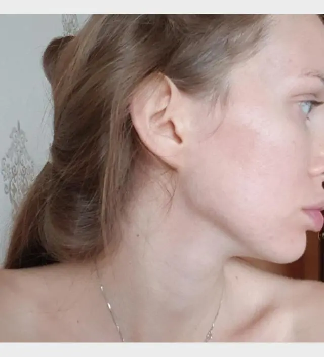 갈락토미 나이아신 에센스 50ml
