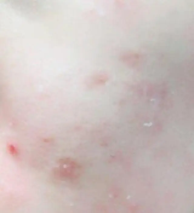 갈락토미 나이아신 에센스 50ml
