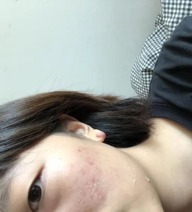 갈락토미 나이아신 에센스 50ml
