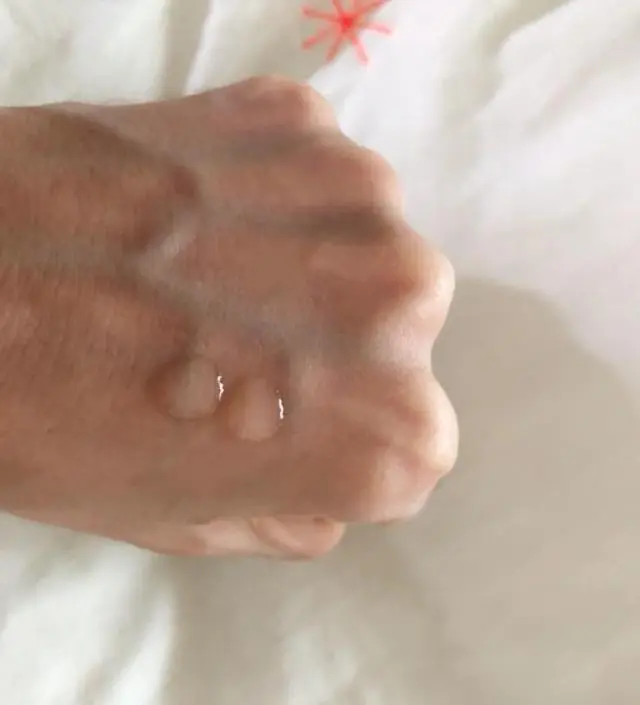 갈락토미 나이아신 에센스 50ml
