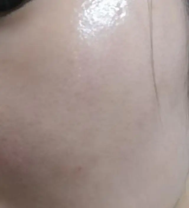 갈락토미 나이아신 에센스 50ml
