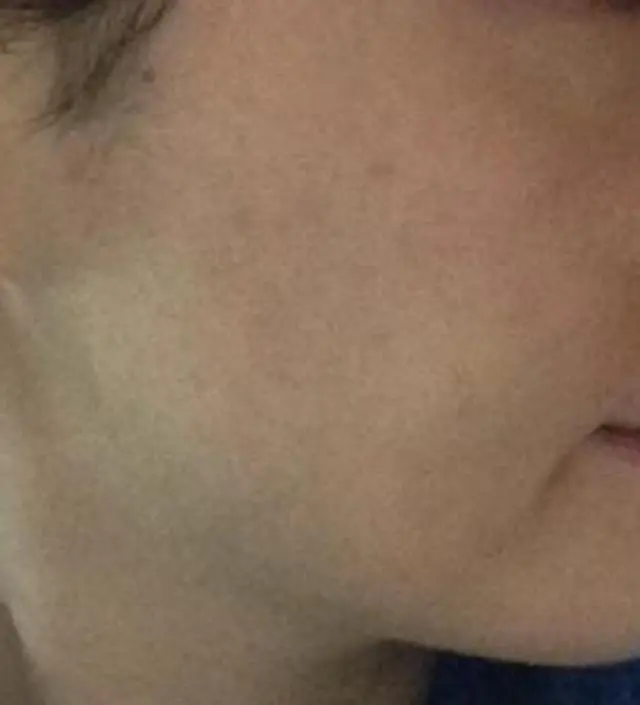 갈락토미 나이아신 에센스 50ml
