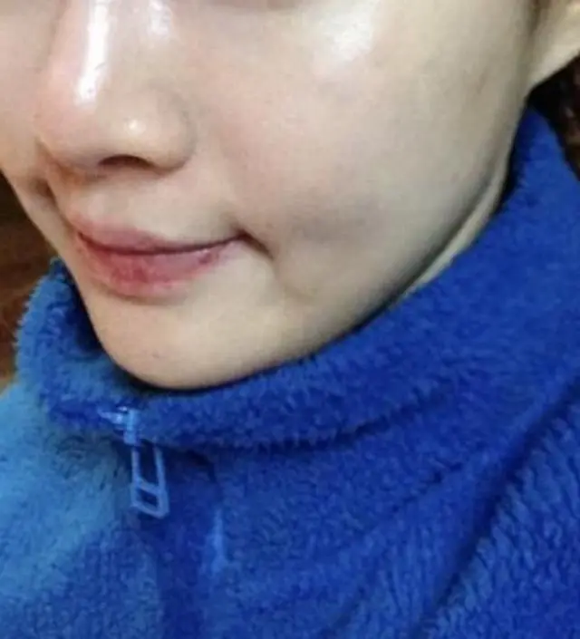 갈락토미 나이아신 에센스 50ml
