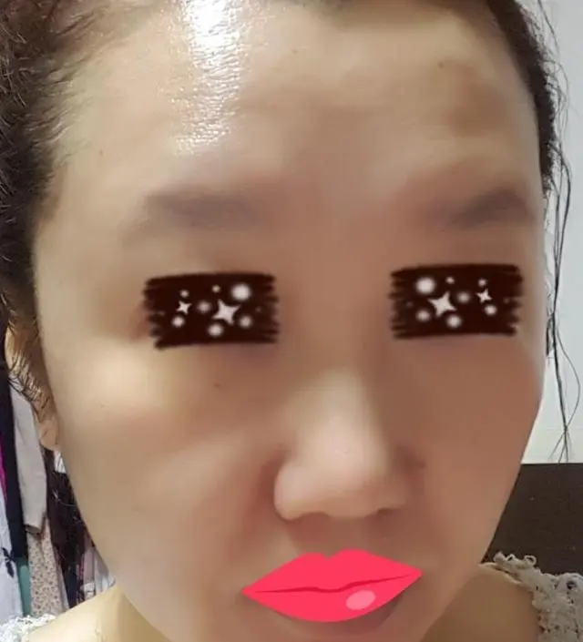 갈락토미 나이아신 에센스 50ml
