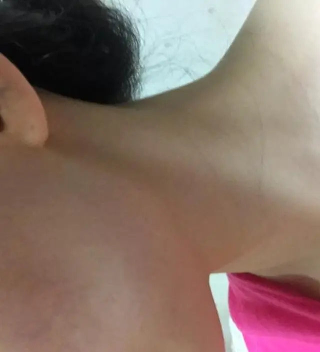 갈락토미 나이아신 에센스 50ml
