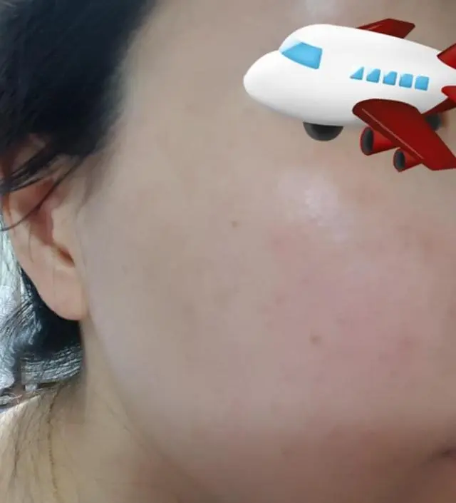 갈락토미 나이아신 에센스 50ml
