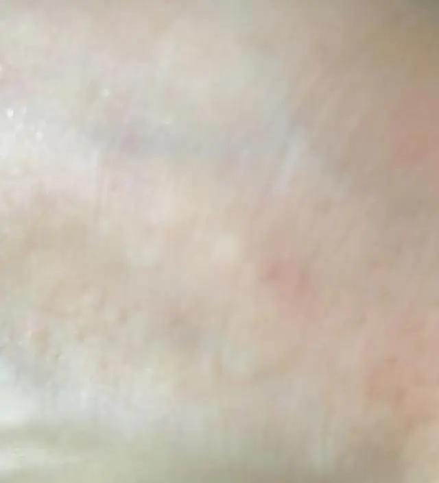 갈락토미 나이아신 에센스 50ml
