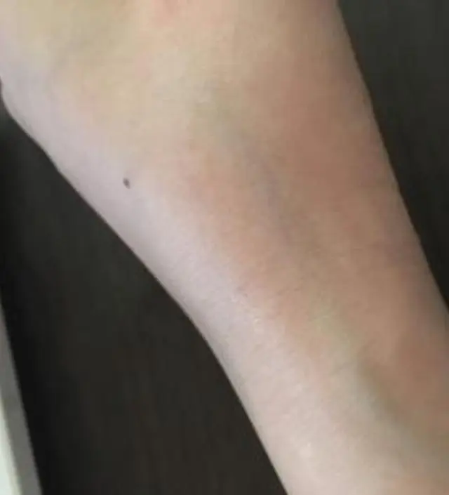 갈락토미 나이아신 에센스 50ml
