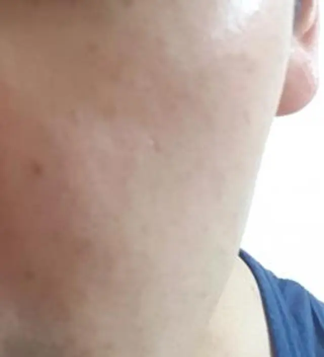 갈락토미 나이아신 에센스 50ml
