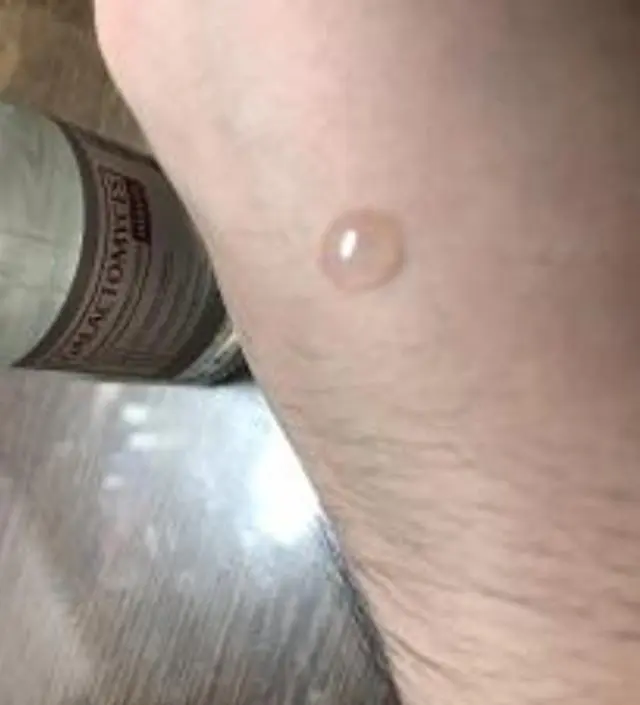 갈락토미 나이아신 에센스 50ml
