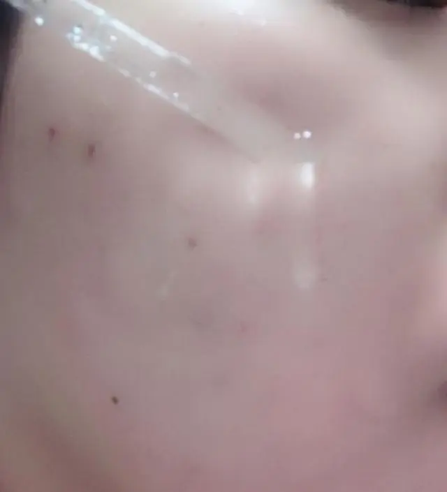 갈락토미 나이아신 에센스 50ml
