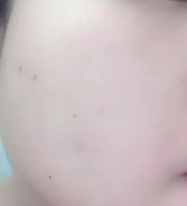 갈락토미 나이아신 에센스 50ml
