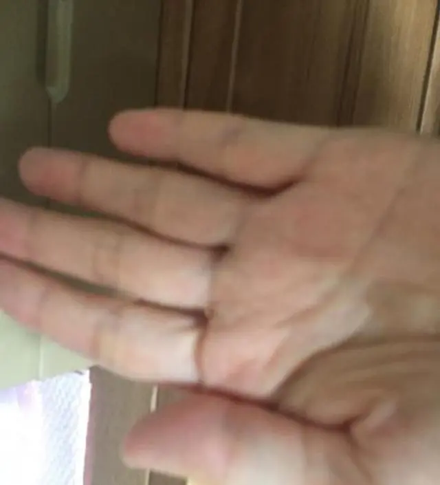 갈락토미 나이아신 에센스 50ml
