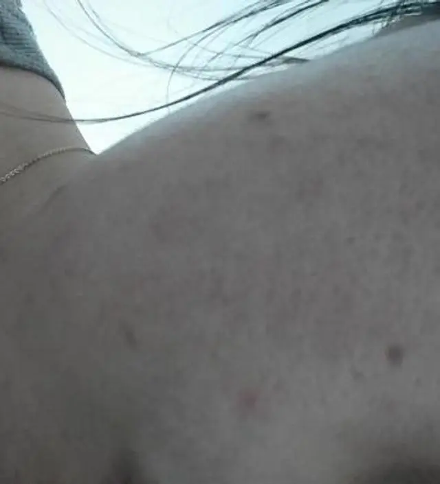 갈락토미 나이아신 에센스 50ml
