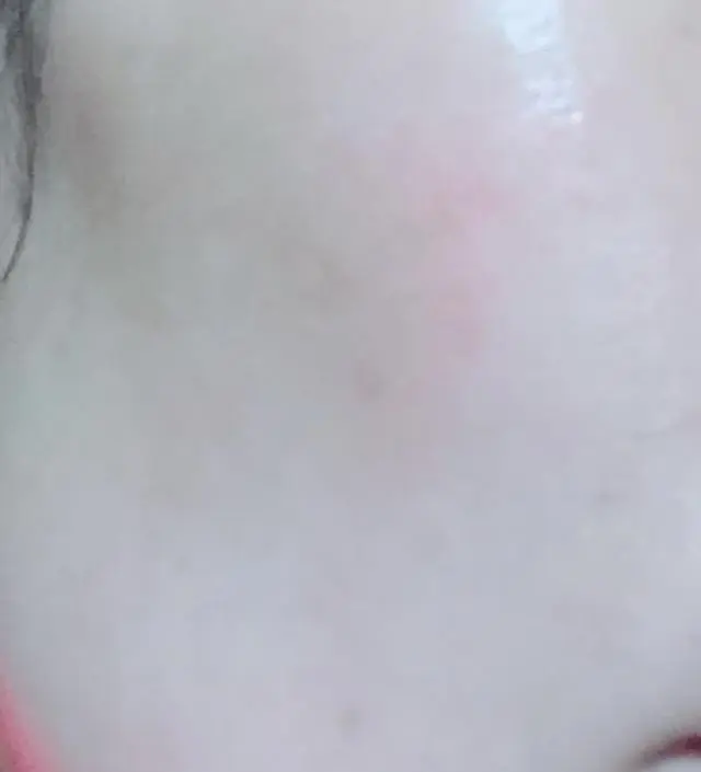 갈락토미 나이아신 에센스 50ml
