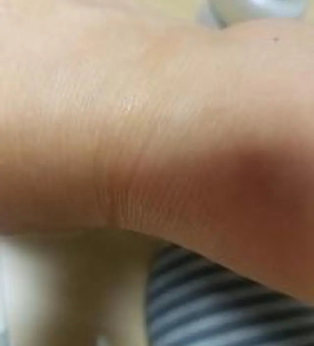 갈락토미 나이아신 에센스 50ml
