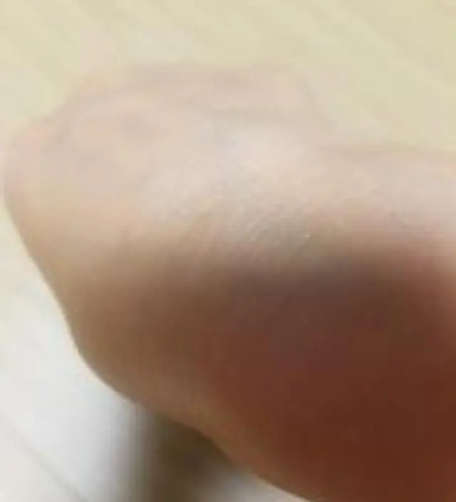 갈락토미 나이아신 에센스 50ml
