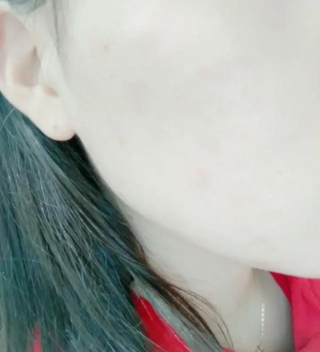 갈락토미 나이아신 에센스 50ml
