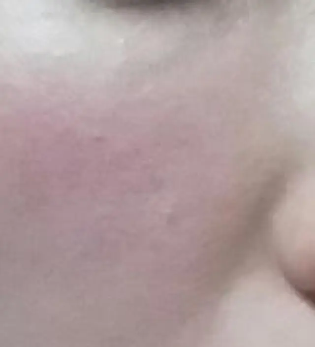 갈락토미 나이아신 에센스 50ml
