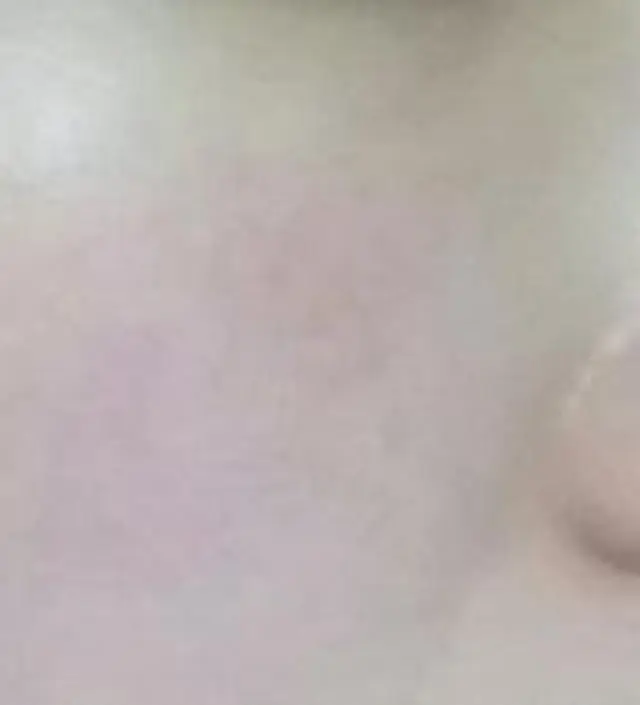 갈락토미 나이아신 에센스 50ml
