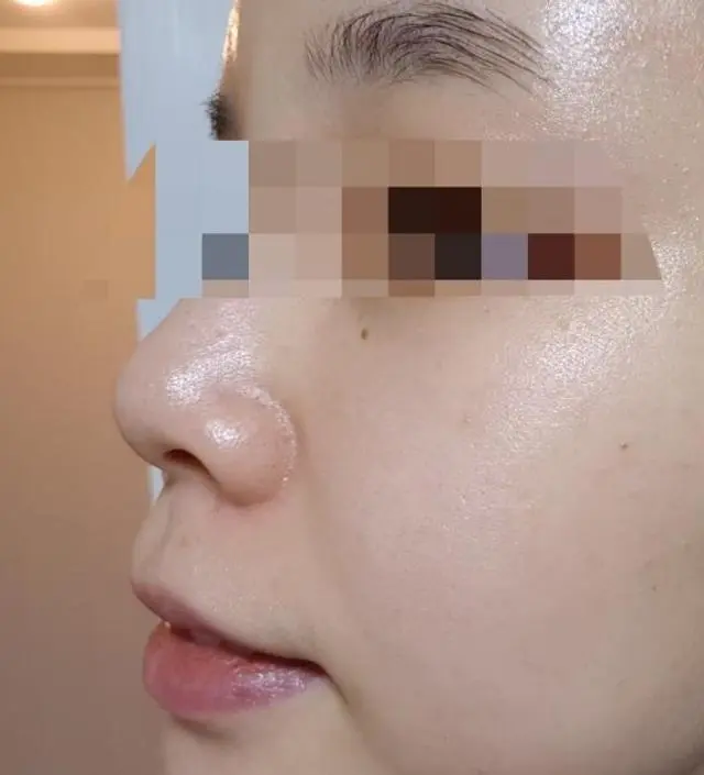 갈락토미 나이아신 에센스 50ml
