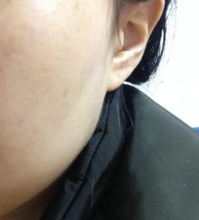 갈락토미 나이아신 에센스 50ml
