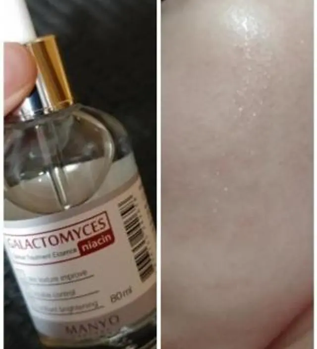 갈락토미 나이아신 에센스 50ml
