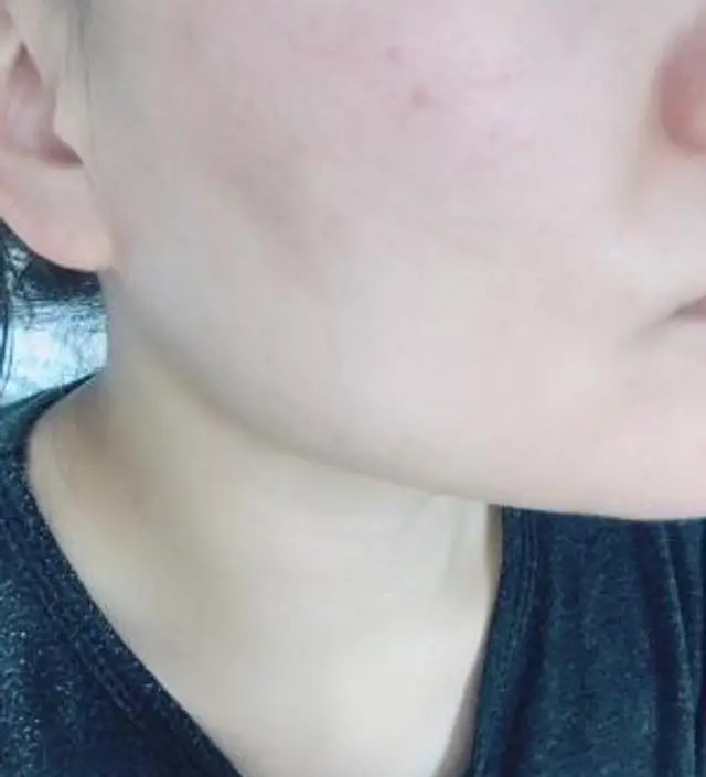 갈락토미 나이아신 에센스 50ml
