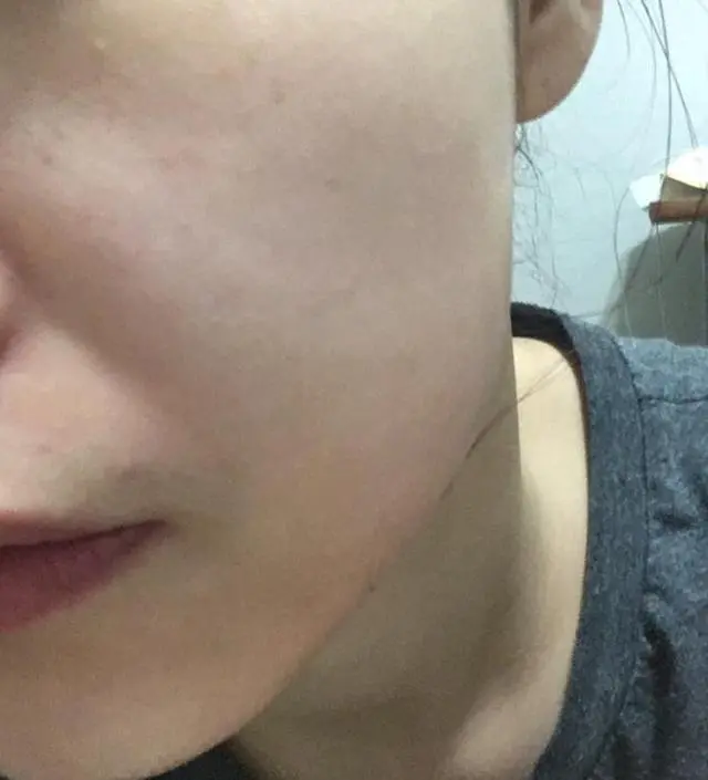 갈락토미 나이아신 에센스 50ml
