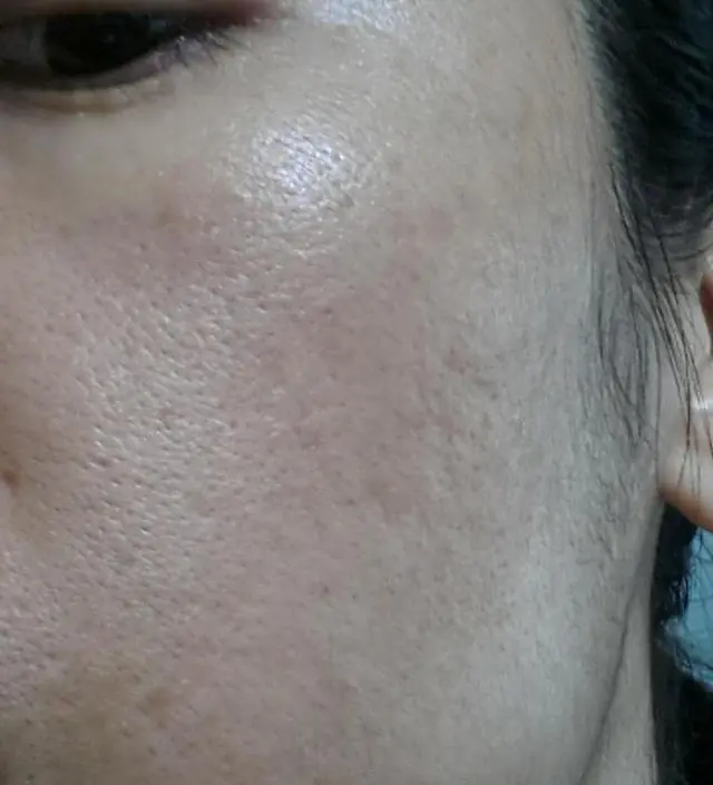 갈락토미 나이아신 에센스 50ml
